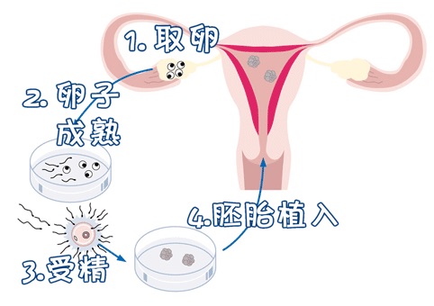 遗传咨询科
